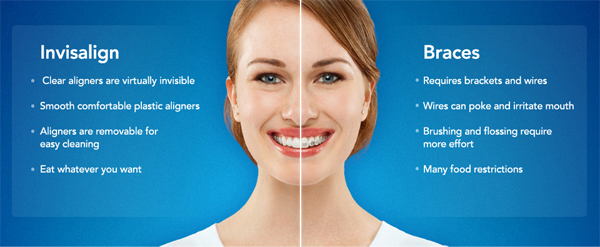 invisalign-slider